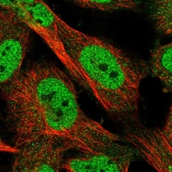 KLHDC3 Antibody, Novus Biologicals 25 &mu;L; Unlabeled:Antibodies, Polyclonal